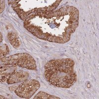 Anti-PLS3 antibody produced in rabbit 