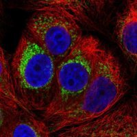 Anti-PMPCA antibody produced in rabbit 