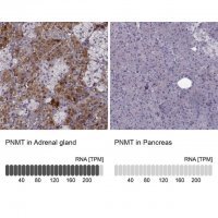Anti-PNMT antibody produced in rabbit 