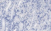 Anti-PNPT1 Antibody, clone 2D23 ZooMAb® Rabbit Monoclonal