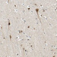 Anti-POGZ antibody produced in rabbit 