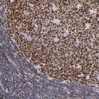 Anti-POLA1 antibody produced in rabbit 