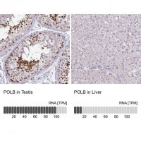 Anti-POLB antibody produced in rabbit 