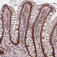 Anti-POLD1 antibody produced in rabbit 