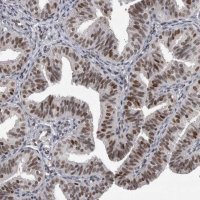 Anti-POLD2 antibody produced in rabbit 