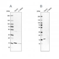 Anti-POLR2H antibody produced in rabbit HPA037745-100UL