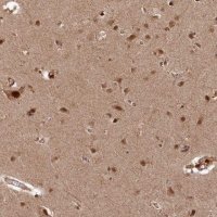 Anti-POLR3A antibody produced in rabbit 