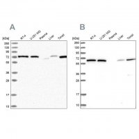 Anti-POLR3E antibody produced in rabbit 