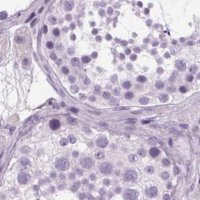 Anti-POMC antibody produced in rabbit