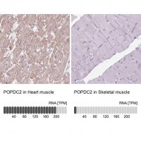 Anti-POPDC2 antibody produced in rabbit 