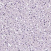 Anti-POPDC2 antibody produced in rabbit 