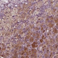 Anti-PORCN antibody produced in rabbit 