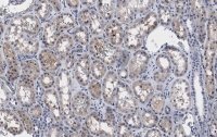 Anti-PP2A C subunit Antibody, clone 2B15 ZooMAb® Rabbit Monoclonal
