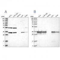 Anti-PPA2 antibody produced in rabbit 