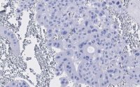 Anti-PPAR Antibody, clone 1I19 ZooMAb� Rabbit Monoclonal 
