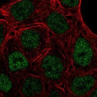 Anti-PPARG antibody produced in rabbit 