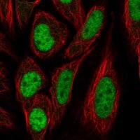 Anti-PPIL4 antibody produced in rabbit