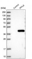 Anti-PPIL6 antibody produced in rabbit HPA036717-100UL