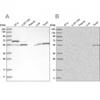 Anti-PPM1F antibody produced in rabbit
