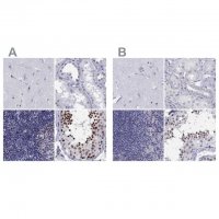 Anti-PPM1G antibody produced in rabbit 