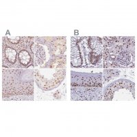 Anti-PPP1R10 antibody produced in rabbit 