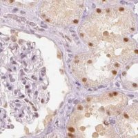 Anti-PPP1R10 antibody produced in rabbit 