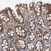 Anti-PPP1R14D antibody produced in rabbit 