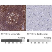 Anti-PPP1R18 antibody produced in rabbit 