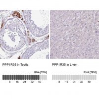 Anti-PPP1R35 antibody produced in rabbit 