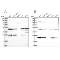 Anti-PPP1R7 antibody produced in rabbit