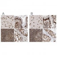 Anti-PPP1R8 antibody produced in rabbit 