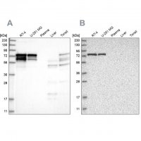 Anti-PPP2R5D antibody produced in rabbit 