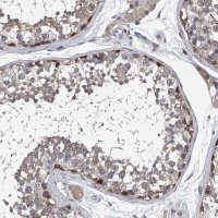 Anti-PPP2R5D antibody produced in rabbit 