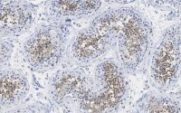 Anti-PPP3CC Antibody, clone 2C2 ZooMAb� Rabbit Monoclonal 
