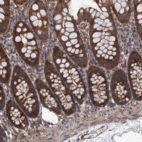 Anti-PPP4R1 antibody produced in rabbit