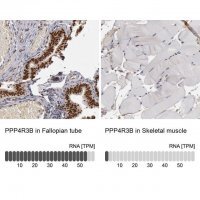 Anti-PPP4R3B antibody produced in rabbit HPA001233-100UL