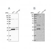 Anti-PPTC7 antibody produced in rabbit 