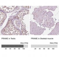 Anti-PRAME antibody produced in rabbit