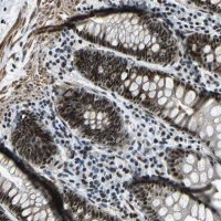 Anti-PRCC antibody produced in rabbit 