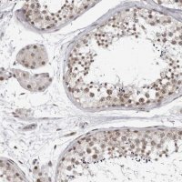Anti-PRDM10 antibody produced in rabbit HPA026997-100UL