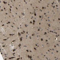 Anti-PREB antibody produced in rabbit