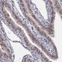 Anti-PRICKLE1 antibody produced in rabbit 