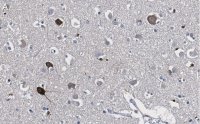 Anti-Prion Protein Antibody, clone 3D17 ZooMAb� Rabbit Monoclonal 