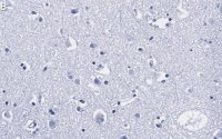 Anti-Prion Protein Antibody, clone 3D17 ZooMAb� Rabbit Monoclonal 