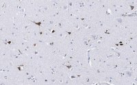 Anti-Prion Protein Antibody, clone 3F17 ZooMAb� Rabbit Monoclonal 