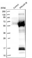 Anti-PRKAR1B antibody produced in rabbit