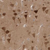 Anti-PRKAR1B antibody produced in rabbit