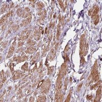 Anti-PRKCDBP antibody produced in rabbit