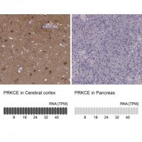Anti-PRKCE antibody produced in rabbit