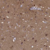 Anti-PRKCE antibody produced in rabbit